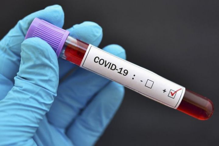 Azərbaycanda koronavirus ilə bağlı son vəziyyət açıqlandı