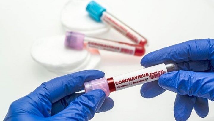 Azərbaycanda koronavirus ilə bağlı son vəziyyət açıqlandı