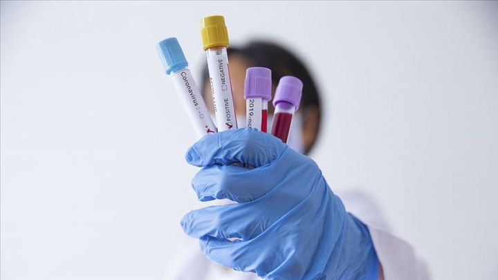 Azərbaycanda koronavirus ilə bağlı son vəziyyət açıqlandı