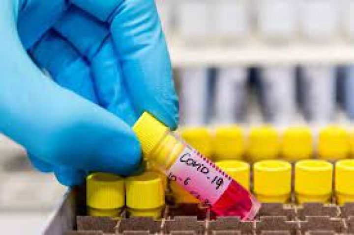 Azərbaycanda koronavirus ilə bağlı son vəziyyət açıqlandı